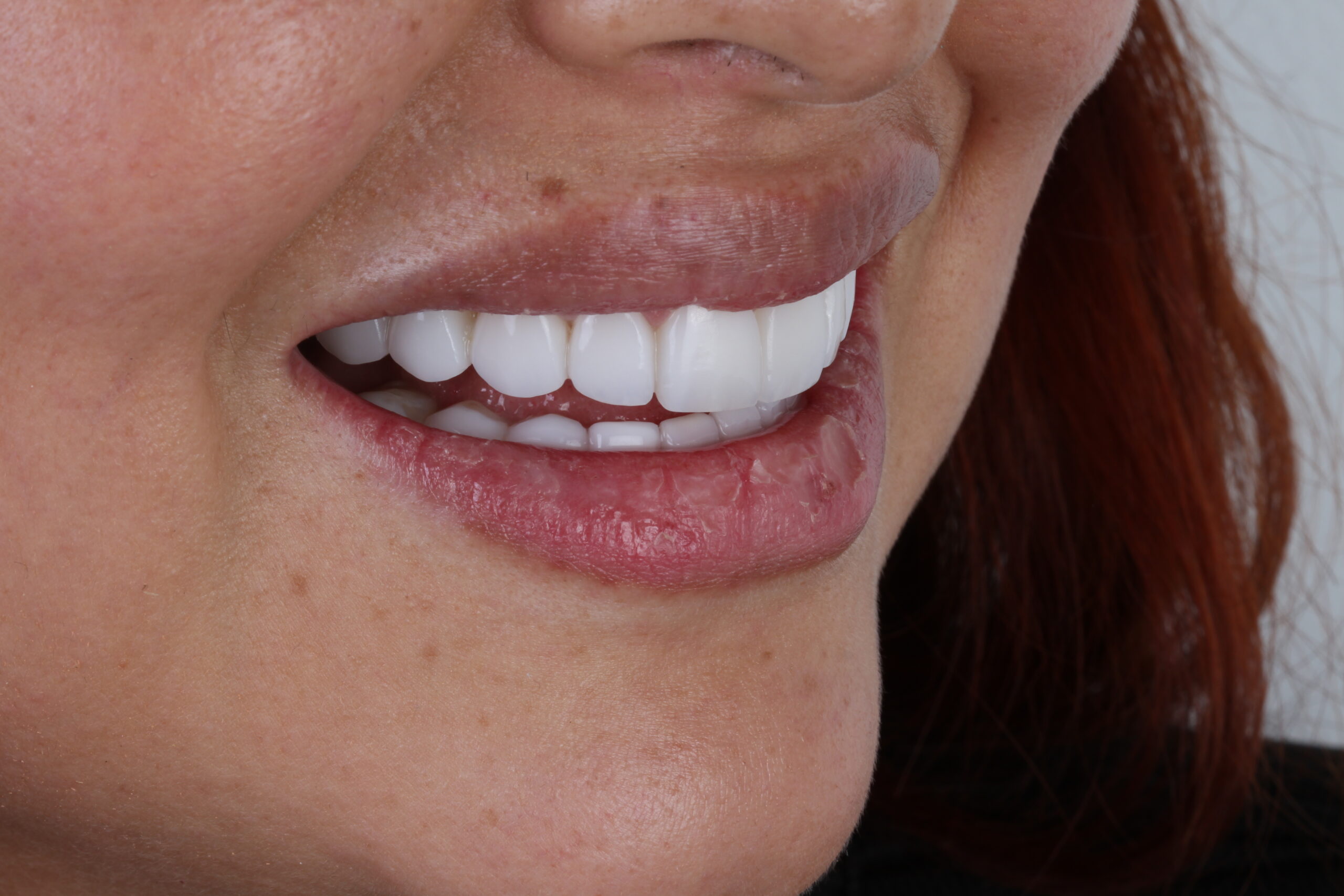 Limpieza dental profesional: ¿por qué es más importante de lo que crees?